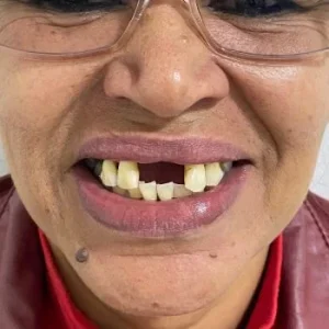 04-ANTES-qlsiuic6b1bsxl339hk1rbq8xxripnb00birp4dx64